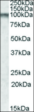 Anti-CPT1C antibody produced in goat affinity isolated antibody, buffered aqueous solution