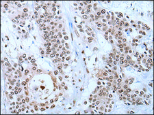 Anti-YY2 affinity isolated antibody
