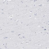 Anti-PAGE1 antibody produced in rabbit Prestige Antibodies® Powered by Atlas Antibodies, affinity isolated antibody, buffered aqueous glycerol solution