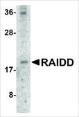 Anti-RAIDD antibody produced in rabbit IgG fraction of antiserum, buffered aqueous solution