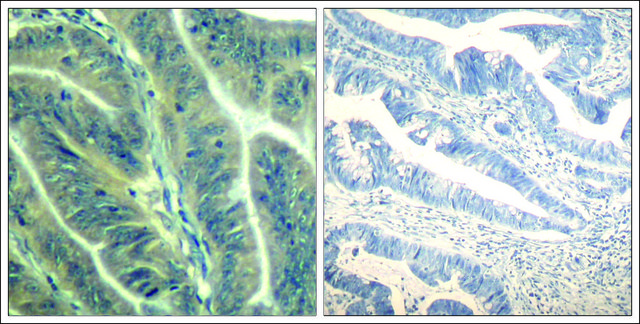 Anti-CDK6 (Ab-24) antibody produced in rabbit affinity isolated antibody