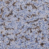 Anti-ADCY10 antibody produced in rabbit Prestige Antibodies® Powered by Atlas Antibodies, affinity isolated antibody, buffered aqueous glycerol solution