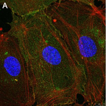 Anti-Integrin &#945;V&#946;3 Antibody, clone LM609 ZooMAb&#174; Mouse Monoclonal recombinant, expressed in HEK 293 cells