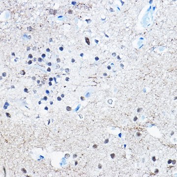 Anti-Phospho-Tau-S396 antibody produced in rabbit