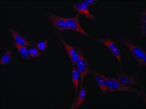 Anti-VAC14 antibody produced in rabbit ~1.5&#160;mg/mL, affinity isolated antibody, buffered aqueous solution