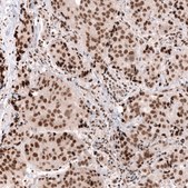 Monoclonal Anti-Smarcb1 Antibody Produced In Mouse Prestige Antibodies® Powered by Atlas Antibodies, clone CL13992, affinity isolated antibody, buffered aqueous glycerol solution