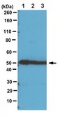 Anti-RhoGAP1 Antibody from rabbit, purified by affinity chromatography