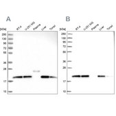 Anti-NDUFA8 antibody produced in rabbit Prestige Antibodies® Powered by Atlas Antibodies, affinity isolated antibody, buffered aqueous glycerol solution