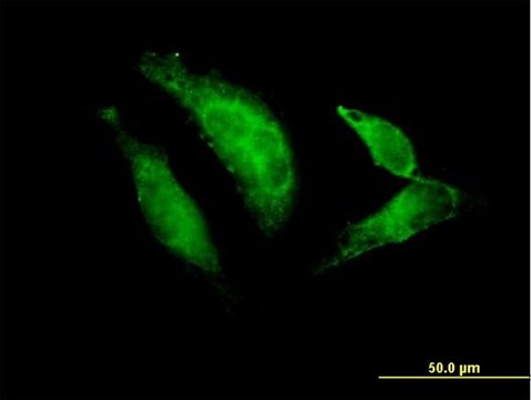 Anti-TBX20 antibody produced in mouse purified immunoglobulin, buffered aqueous solution