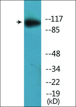 抗-磷酸--MER/SKY (pTyr749/681) 兔抗 affinity isolated antibody