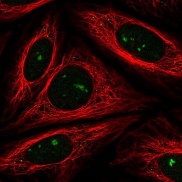 Anti-FBXW11 antibody produced in rabbit Prestige Antibodies&#174; Powered by Atlas Antibodies, affinity isolated antibody