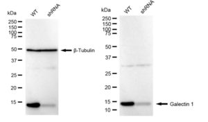 KD-Validated Anti Galectin 1 Antibody, clone 23GB6280, Rabbit Monoclonal clone 23GB6280, recombinant rabbit monoclonal, expressed in HEK293 cells