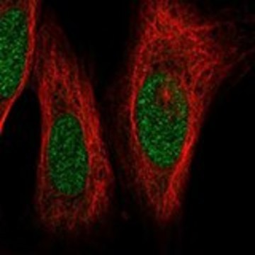 Anti-LHX1 antibody produced in rabbit Prestige Antibodies&#174; Powered by Atlas Antibodies, affinity isolated antibody, buffered aqueous glycerol solution