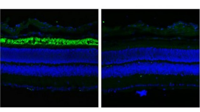 Anti-ABCA4 Antibody, clone TMR1 clone TMR1, from mouse