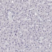 Anti-GUCA1A antibody produced in rabbit Prestige Antibodies® Powered by Atlas Antibodies, affinity isolated antibody