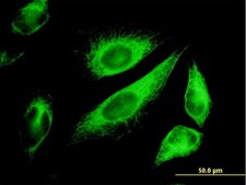 Monoclonal Anti-KRT18 antibody produced in mouse clone 2F8, purified immunoglobulin, buffered aqueous solution