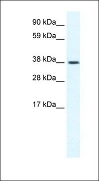 Anti-TRPM3 antibody produced in rabbit affinity isolated antibody