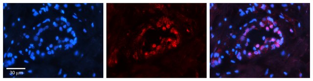 Anti-PAX8 antibody produced in rabbit affinity isolated antibody