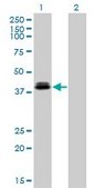 Monoclonal Anti-OTX1 antibody produced in mouse clone 1F2, purified immunoglobulin, buffered aqueous solution