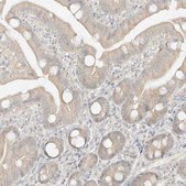 Anti-LIPT1 antibody produced in rabbit Prestige Antibodies® Powered by Atlas Antibodies, affinity isolated antibody, buffered aqueous glycerol solution