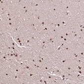 Anti-PDS5B antibody produced in rabbit Prestige Antibodies® Powered by Atlas Antibodies, affinity isolated antibody, buffered aqueous glycerol solution