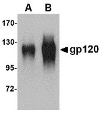 Anti-gp120 antibody produced in goat affinity isolated antibody