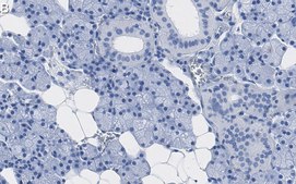 Anti-PHGDH Antibody, clone 1E6 ZooMAb® Rabbit Monoclonal recombinant, expressed in HEK 293 cells