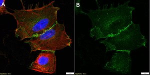 Anti-iRhom2/RHBDF2 Antibody, clone 1F17 ZooMAb® Rabbit Monoclonal recombinant, expressed in HEK 293 cells