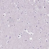 Anti-CD5L antibody produced in rabbit Prestige Antibodies® Powered by Atlas Antibodies, affinity isolated antibody, buffered aqueous glycerol solution