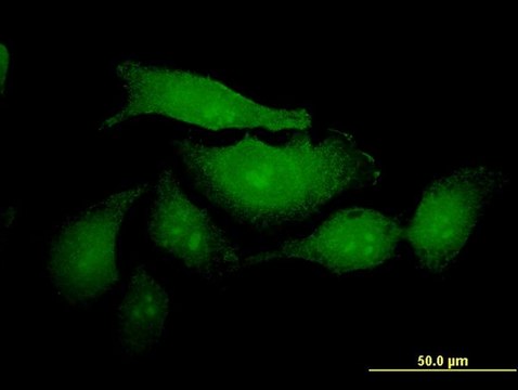 ANTI-MUC2 antibody produced in mouse clone 2A9, purified immunoglobulin, buffered aqueous solution