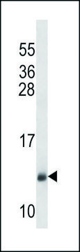 ANTI-SEC61B (CENTER) antibody produced in rabbit IgG fraction of antiserum, buffered aqueous solution