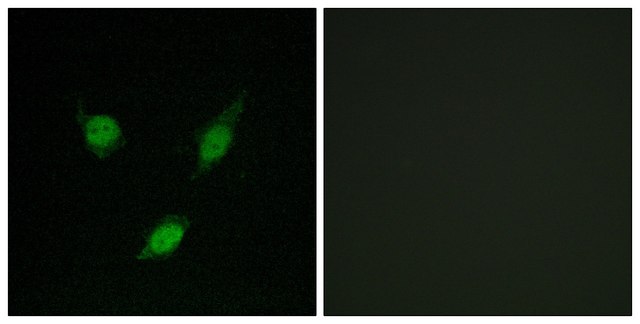 Anti-TACC1 antibody produced in rabbit affinity isolated antibody