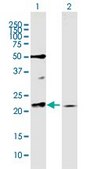 Anti-RAB11A antibody produced in mouse purified immunoglobulin, buffered aqueous solution