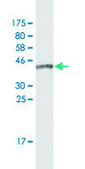 Monoclonal Anti-IFT20 antibody produced in mouse clone 3F3, purified immunoglobulin, buffered aqueous solution