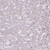 Anti-HEXB antibody produced in rabbit Prestige Antibodies® Powered by Atlas Antibodies, affinity isolated antibody, buffered aqueous glycerol solution