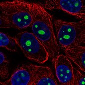 Anti-KRI1 antibody produced in rabbit Prestige Antibodies® Powered by Atlas Antibodies, affinity isolated antibody, buffered aqueous glycerol solution