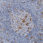 Anti-SKAP2 antibody produced in rabbit Prestige Antibodies® Powered by Atlas Antibodies, affinity isolated antibody, buffered aqueous glycerol solution