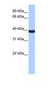 Anti-PAX2 IgG fraction of antiserum