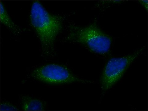 Anti-AMSH-LP / STAMBPL1 (C-terminal) antibody produced in rabbit ~1&#160;mg/mL, affinity isolated antibody