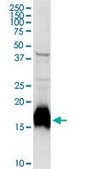 Anti-NPC2 antibody produced in rabbit purified immunoglobulin, buffered aqueous solution