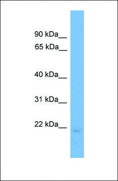 Anti-EDN2, (N-terminal) antibody produced in rabbit affinity isolated antibody