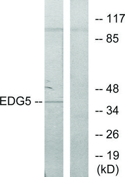 Anti-EDG5 antibody produced in rabbit affinity isolated antibody