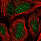 Anti-RDH14 antibody produced in rabbit Prestige Antibodies® Powered by Atlas Antibodies, affinity isolated antibody, buffered aqueous glycerol solution