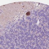 Anti-NOS1AP antibody produced in rabbit Prestige Antibodies® Powered by Atlas Antibodies, affinity isolated antibody, buffered aqueous glycerol solution