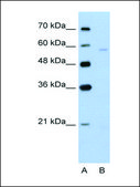 Anti-SLC22A7 (AB2) antibody produced in rabbit IgG fraction of antiserum