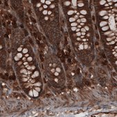 Monoclonal Anti-CARS antibody produced in mouse Prestige Antibodies® Powered by Atlas Antibodies, clone CL2309, purified immunoglobulin, buffered aqueous glycerol solution