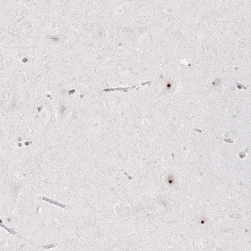 Anti-CHD2 antibody produced in rabbit Prestige Antibodies&#174; Powered by Atlas Antibodies, affinity isolated antibody, buffered aqueous glycerol solution