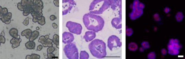 3dGRO&#174; Human CRC Organoids (ISO49)