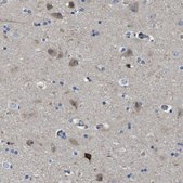 Anti-SCN4B antibody produced in rabbit Prestige Antibodies® Powered by Atlas Antibodies, affinity isolated antibody, buffered aqueous glycerol solution