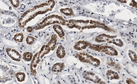 Anti-Smad3 Antibody, clone 1J11, ZooMAb® Rabbit Monoclonal recombinant, expressed in HEK 293 cells